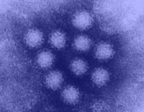 Norovirus