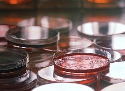 Bacteria Cultures