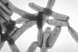 Legionella_pneumophila